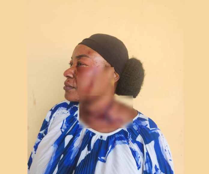 N/R: NDC vice president allegedly assaults treasurer over funds
