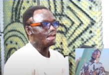 Acid attack survivor shares sad story