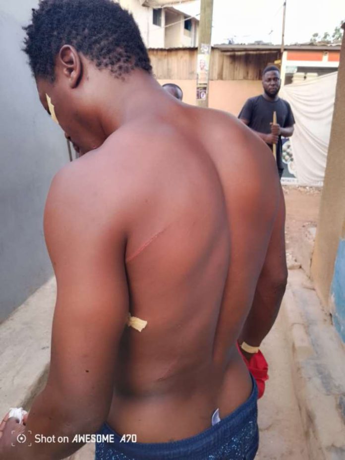 Richard Tema attack victim