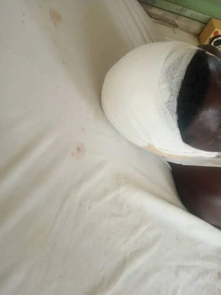 Man beaten to pulp over alleged missing genitals at Senya Bereku [Photos]