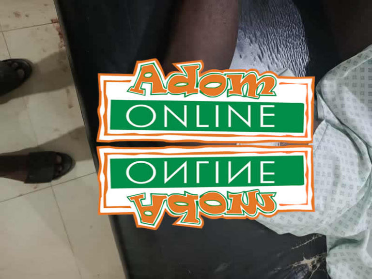 Two hit by stray bullet as Police clash with ‘wee smokers’ [Photos]