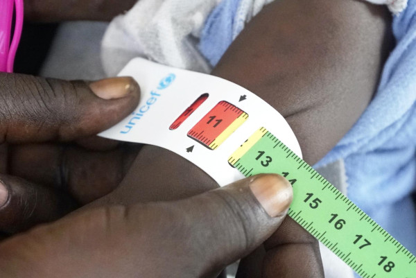 Saving lives and empowering communities in South Sudan’s remote areas: Akon's journey from despair to hope