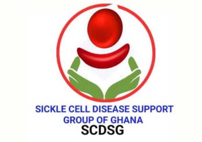 sickle cell