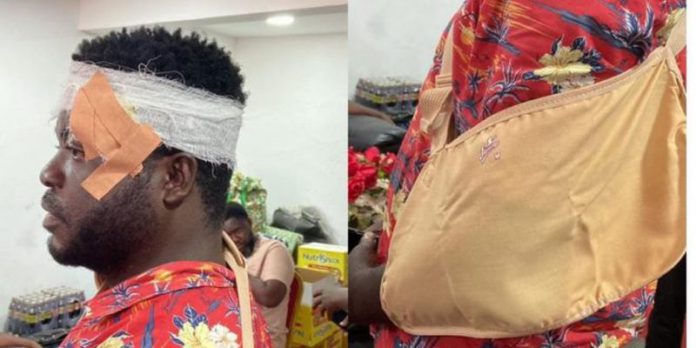 TESCON member sustains head injury TESCON member sustains head injury