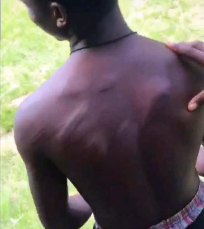 Teacher inflicts cane injuries on pupils for wearing unprescribed uniform