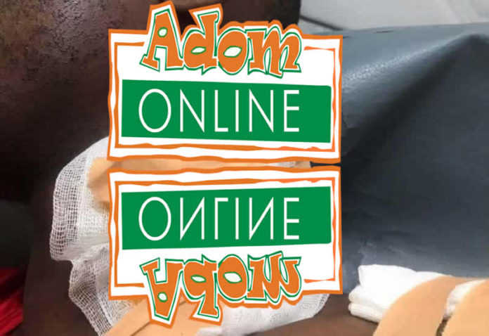 Nigerian Stabs Colleague in Neck with Bottle