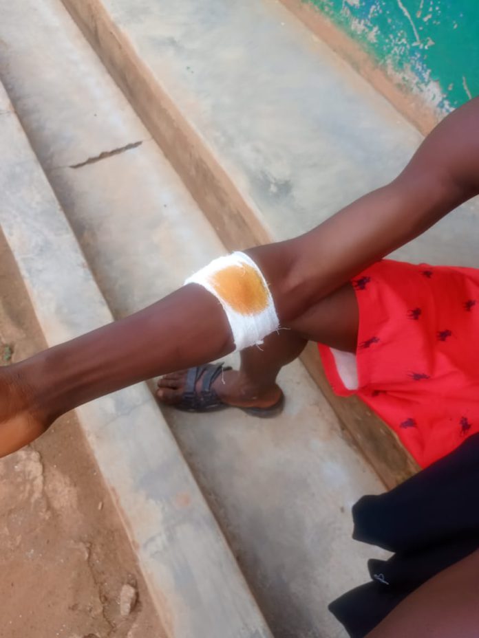 Chief allegedly shoots 18-year-old at Sehwi Kwasikrom amid tensions Chief allegedly shoots 18-year-old at Sehwi Kwasikrom amid tensions