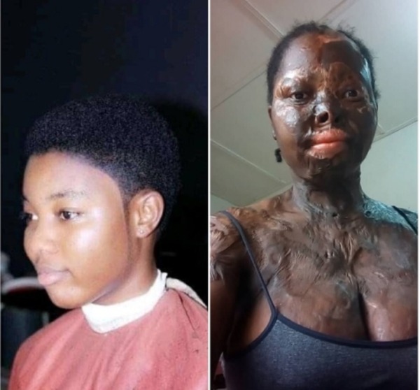 Martha Asiamah acid (1)