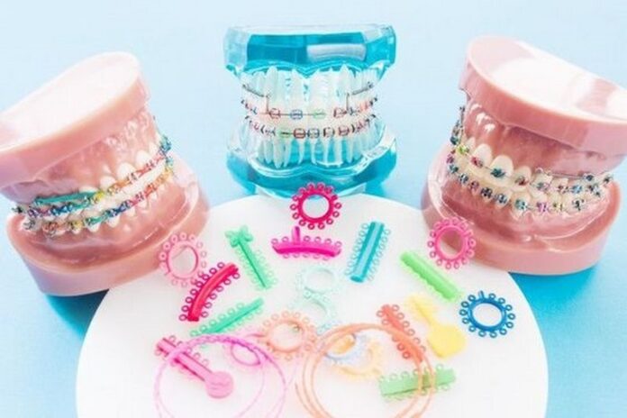 bracescrop (Copy)