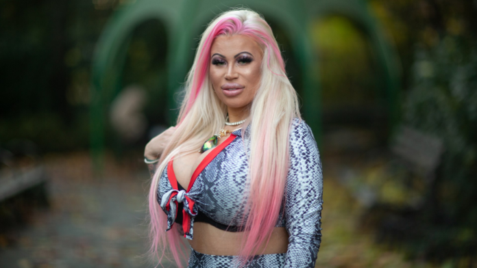 Woman who's undergone over 500 plastic surgeries struggling to find a man