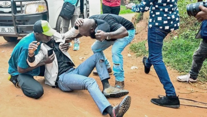 Uganda’s Bobi Wine injured by policeman