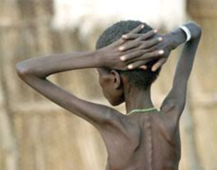 Conflict in Bawku worsens malnutrition crisis, claims two lives Conflict in Bawku worsens malnutrition crisis, claims two lives