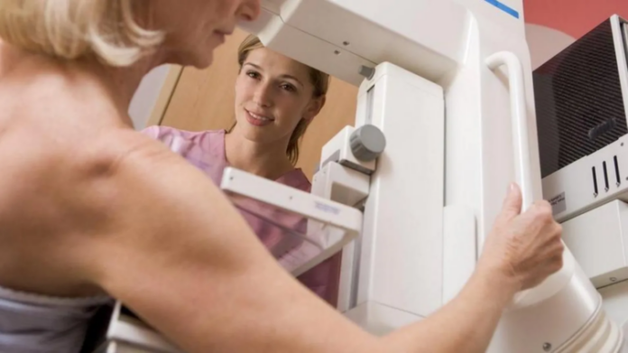 AI breast cancer screening