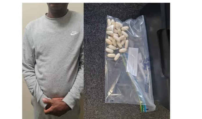 Man arrested at airport with cocaine pellets in his stomach