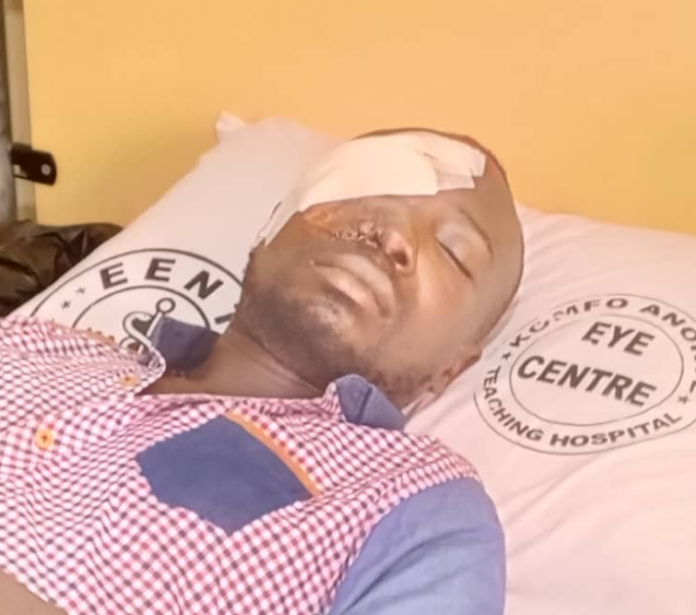 Man risks losing sight after being crushed by falling log at Bibiani