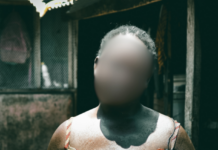 Medical error: Woman can’t control urine after childbirth