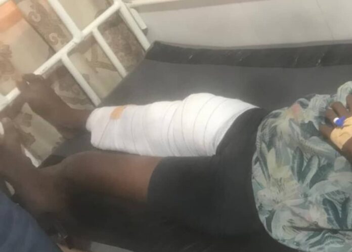 One in critical condition, two injured after tree falls on residents at Buduburam