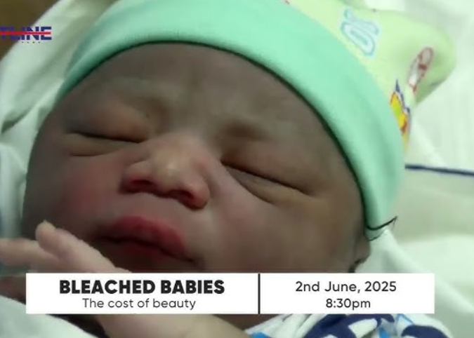 Bleached children may have brain challenge, other health complications – Dr Beyuo