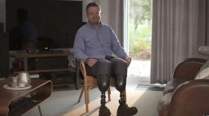 Neil Hopper was motivated by sexual interest in amputation, the court heard.
