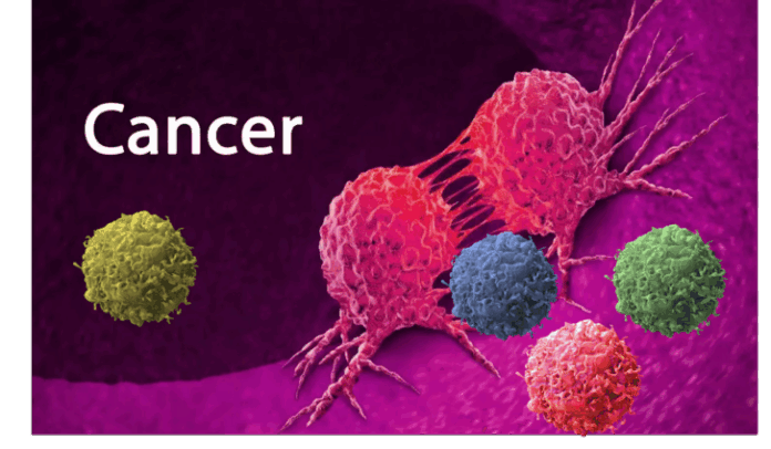 cancer-727x424 (1)